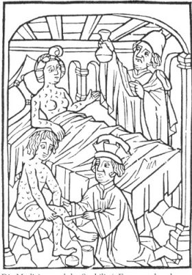 syphilis mercure moyen age - syphylis middle ages