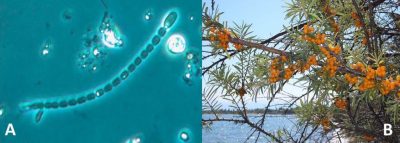 环境百科全书-靠空气生存的植物-生物固氮细菌