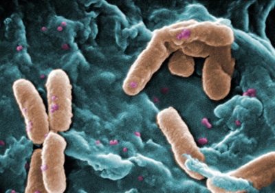 bacteries - pseudomonas aeruginosa