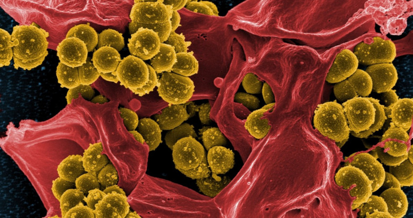 biofilm - biofilms - bacterie - bacteries